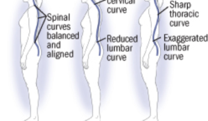 Good Posture, It’s more than you think.
